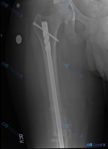 Post 700 image 1