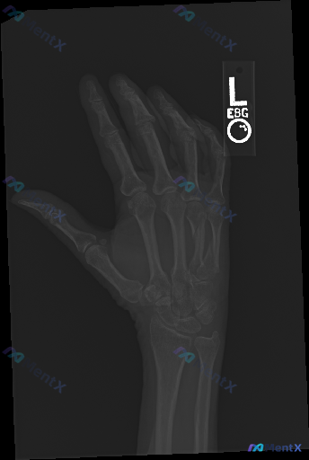 Post Image 1