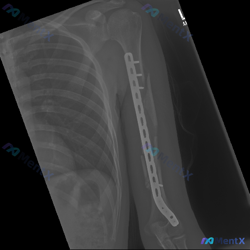 Post 3101 image 1