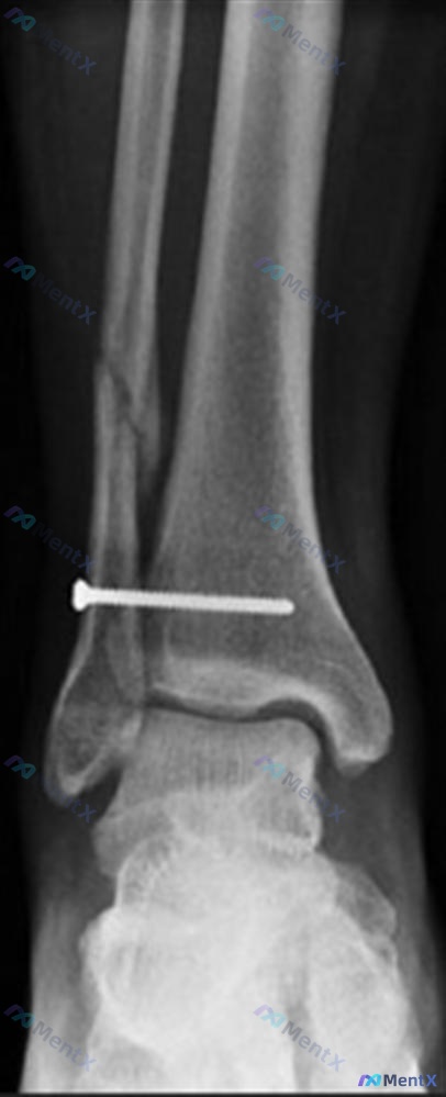 Post 2330 image 3