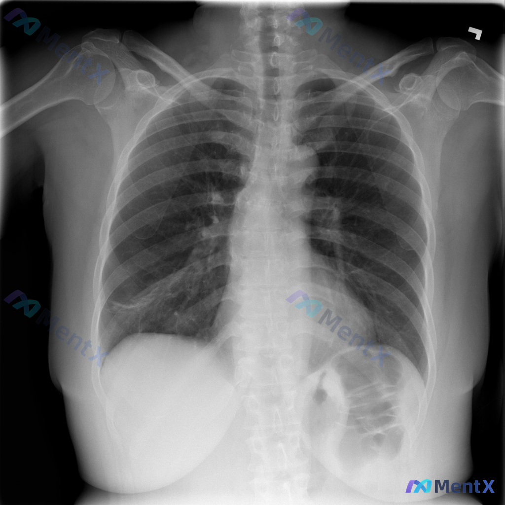 Post 2135 image 1