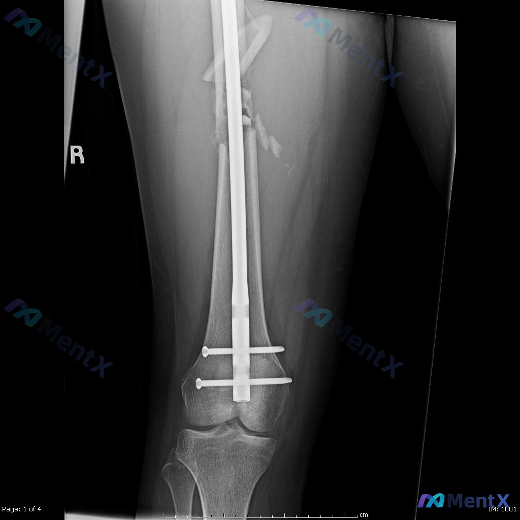 Post Image 4