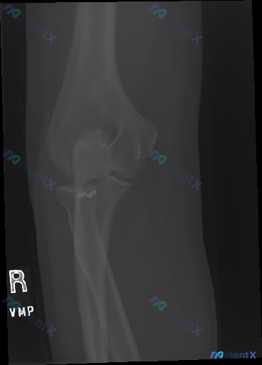 Post 5653 image 1