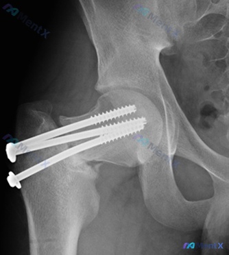 Post 1117 image 3
