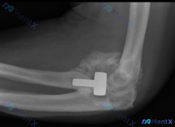 Post 585 image 1