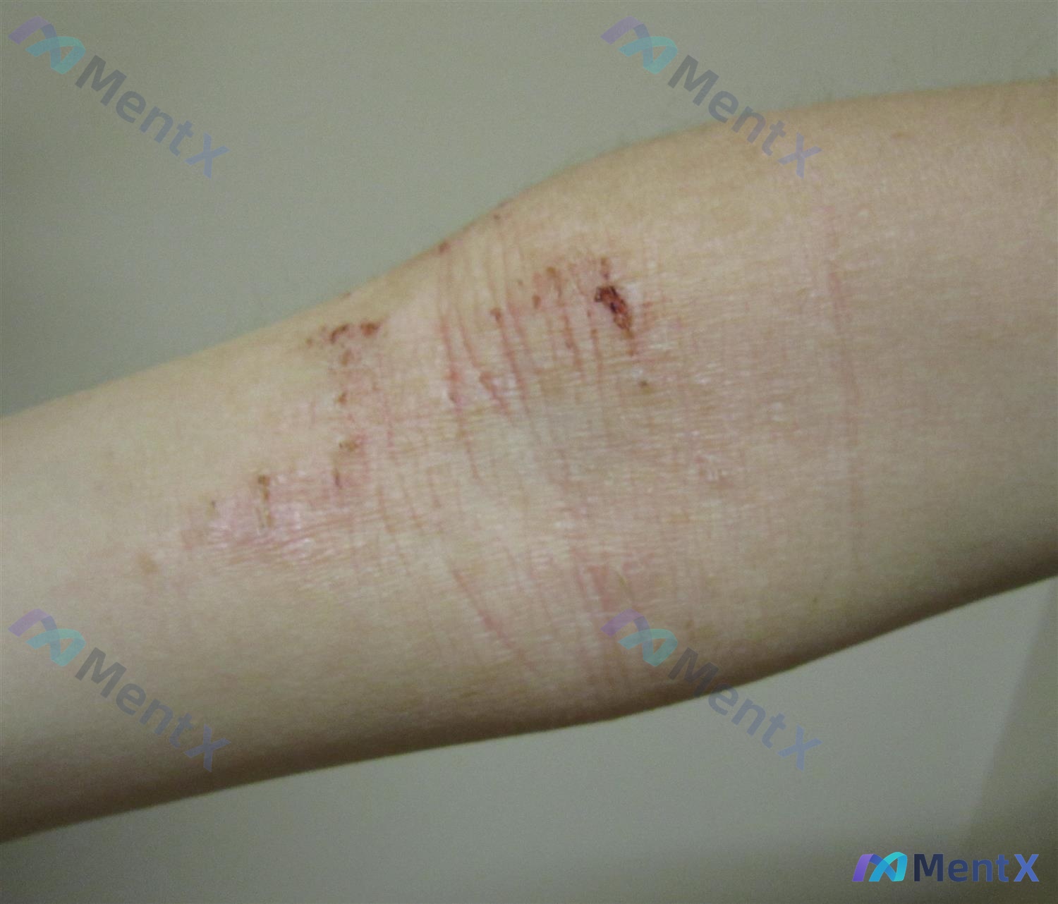 Post 438 image 1