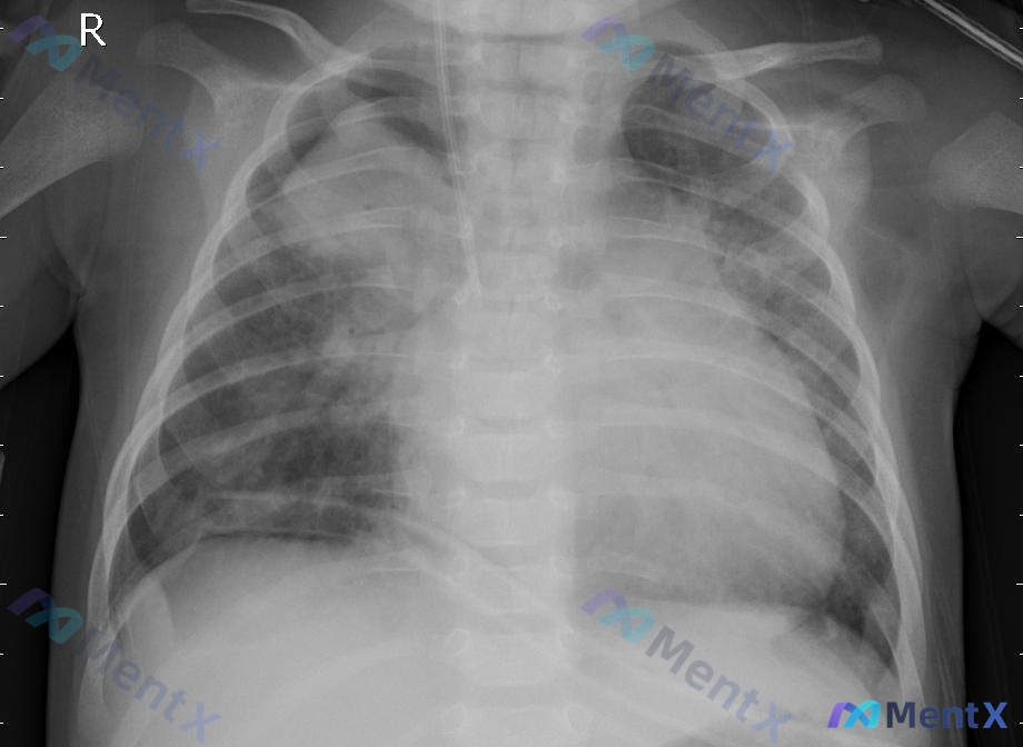 Post 1732 image 1