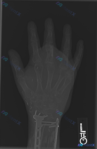 Post 5317 image 1