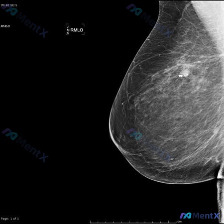 Post 95 image 2
