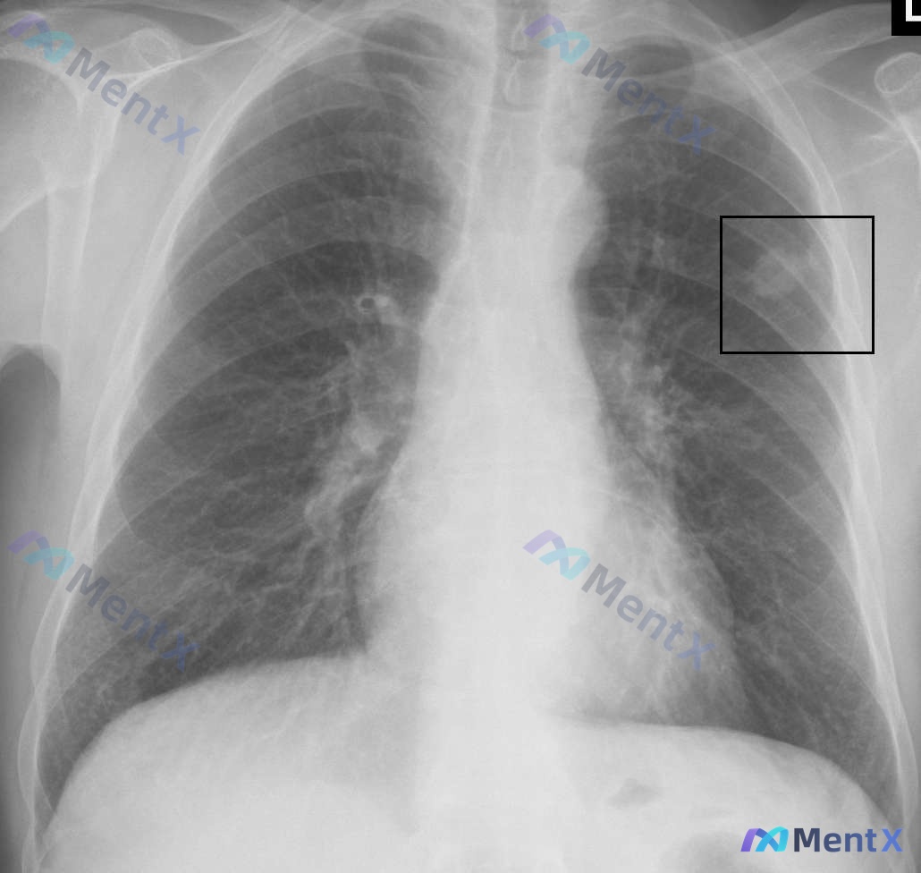 Post 38 image 1