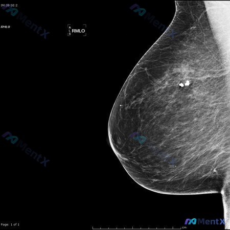 Post Image 4