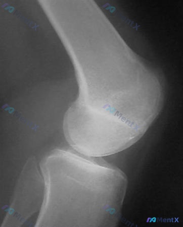 Post 1999 image 2
