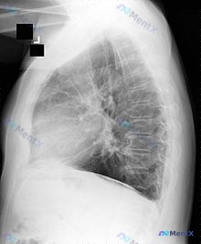 Post 1241 image 1