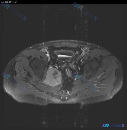 Post 423 image 1