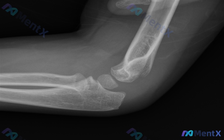 Post 2126 image 2