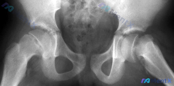 Post 1117 image 1