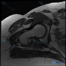 Post 28900 image 1