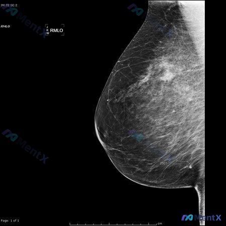 Post 95 image 1