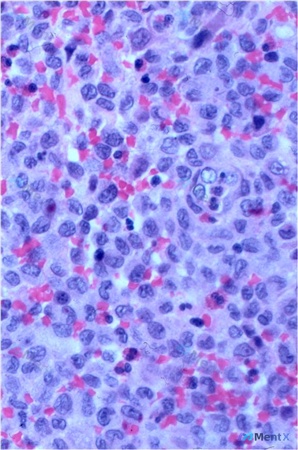 Post 998 image 3