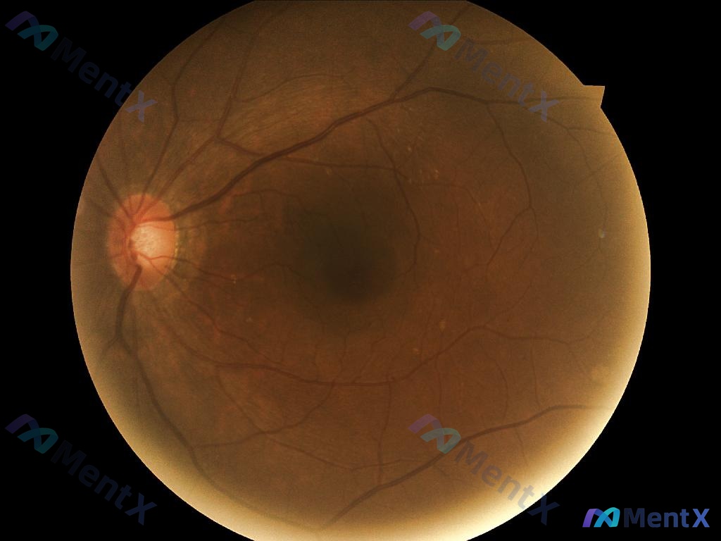 Post 215 image 1