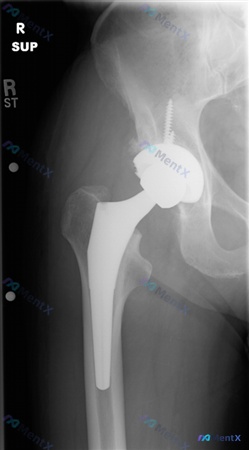 Post 170 image 2