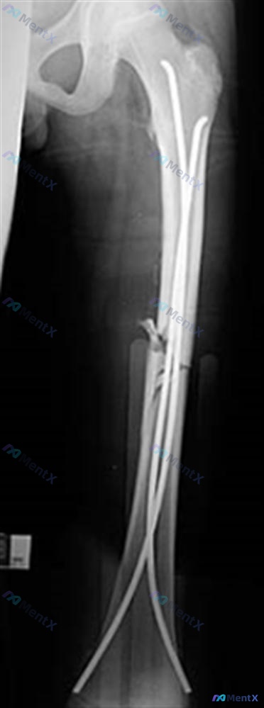 Post Image 5
