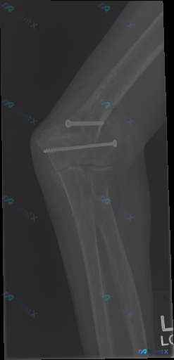 Post Image 1