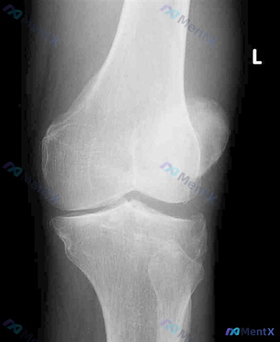 Post 1974 image 3