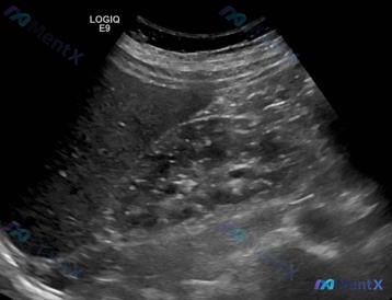 Post 1150 image 2
