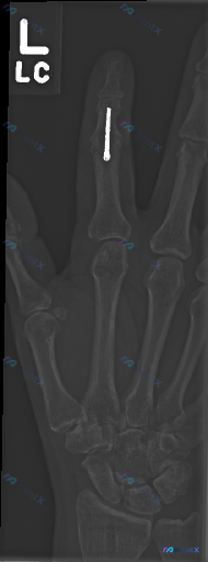 Post Image 1