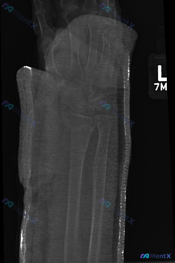 Post 4101 image 1