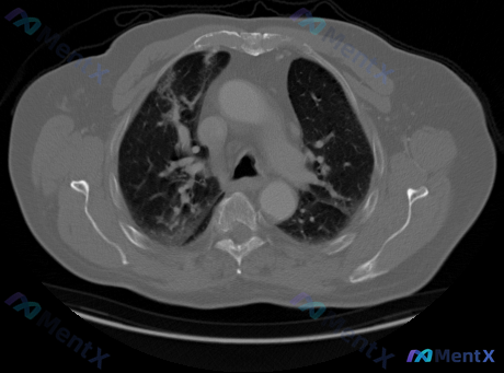 Post 536 image 1