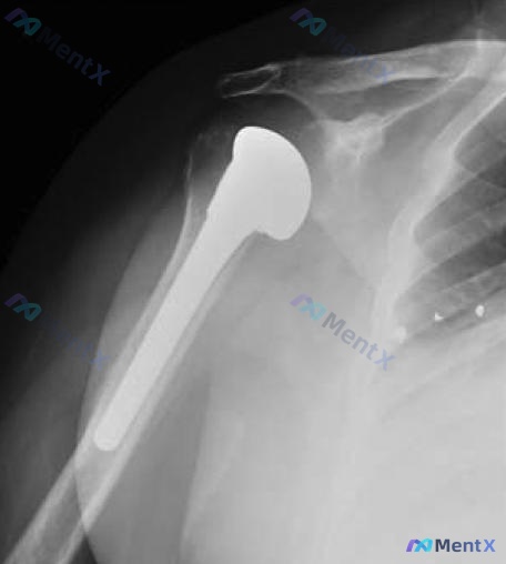 Post 2333 image 3