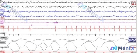 Post 803 image 1