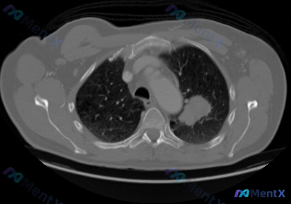 Post 1650 image 1