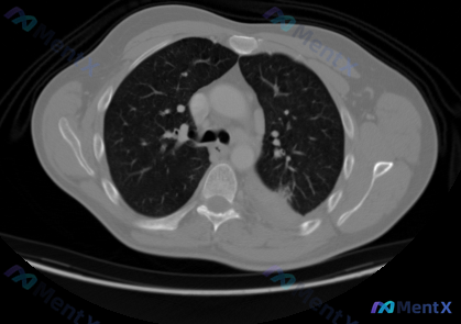Post 223 image 1