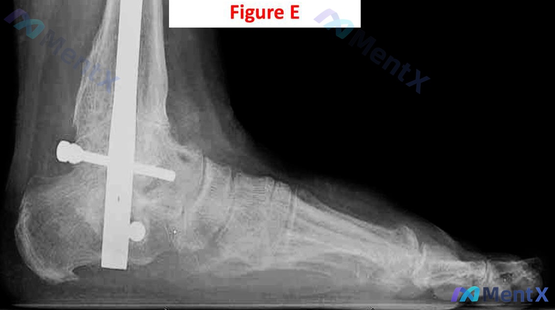 Post Image 5