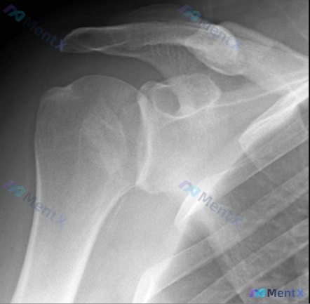 Post 169 image 1