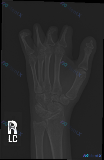 Post Image 1