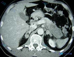Post 50 image 1