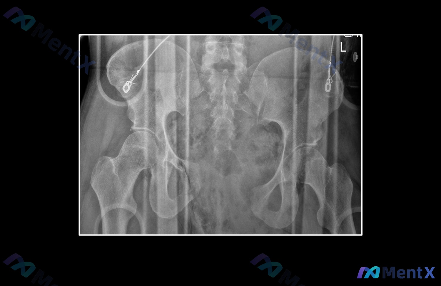 Post 1047 image 1