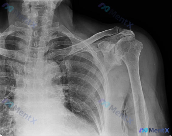 Post 413 image 2