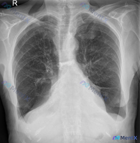 Post 2615 image 1