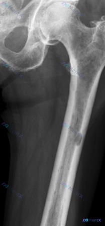 Post 200 image 2