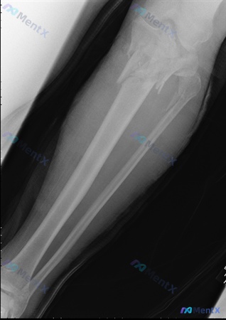 Post Image 5