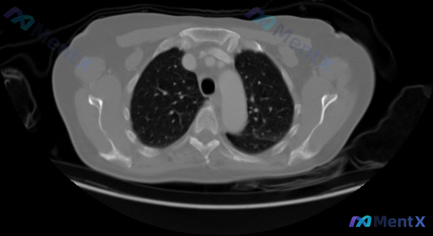 Post 113 image 1