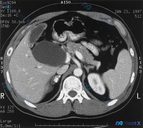Post 2275 image 1