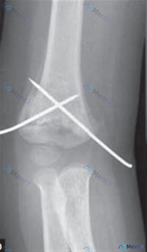 Post 2330 image 4