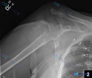 Post 2950 image 1