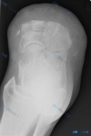 Post 1114 image 3